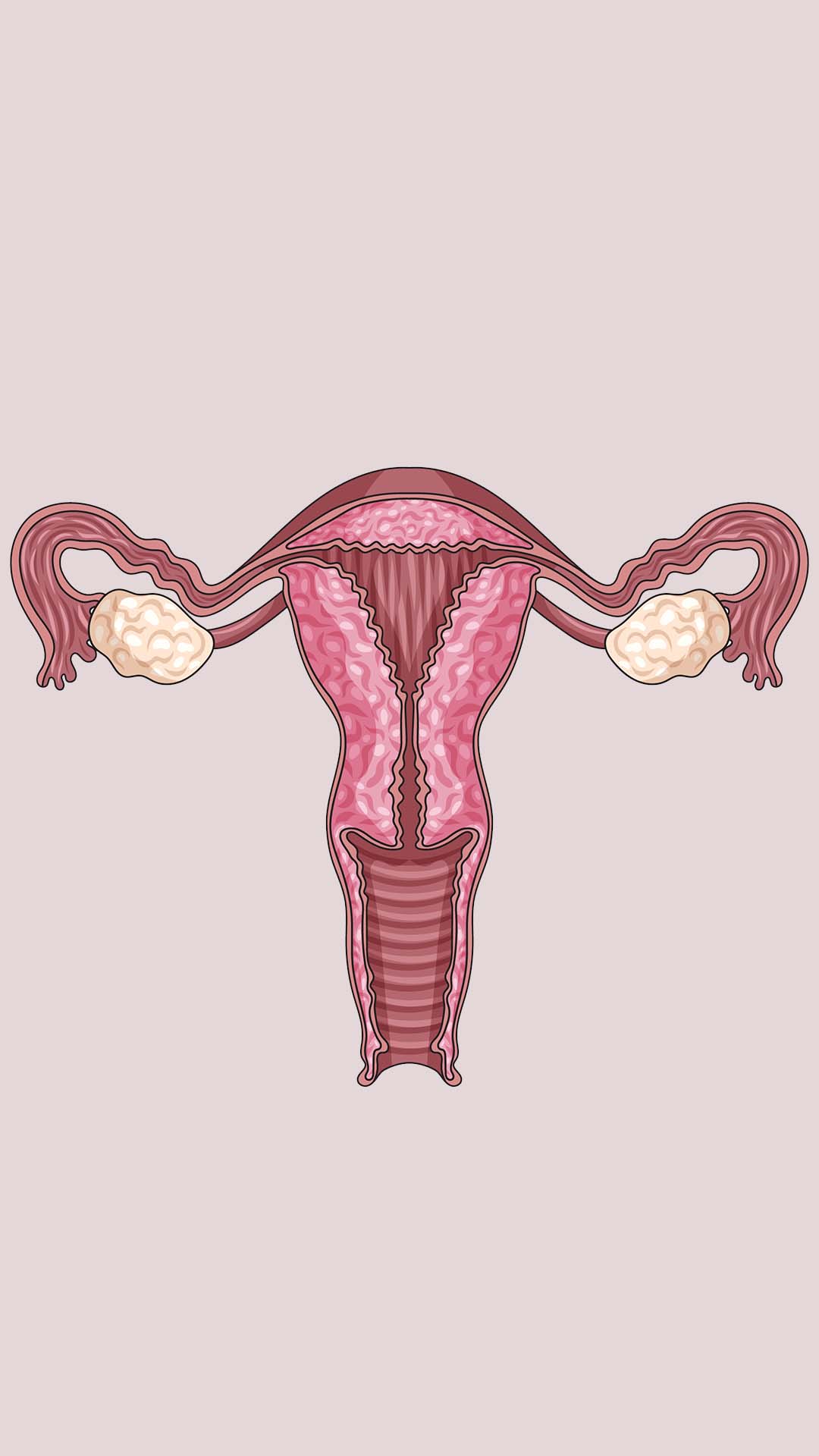 Illustration of Varicose Veins